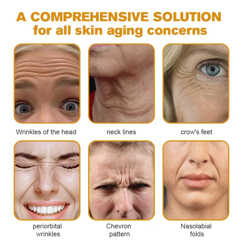 💥BUY 1 GET 1 FREE💥Botox Bee Venom Wrinkle Removal Cream