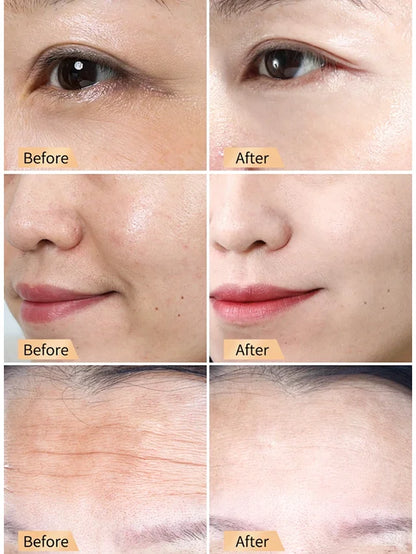 🔥Buy 1 Get 1 Free🔥Snail Hydrating Anti-Wrinkle and Rejuvenating Cream