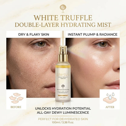 ✨ White Truffle Double-Layer Hydrating MistHE——Korean Glass Skin Starts With One Spray 💧🤍