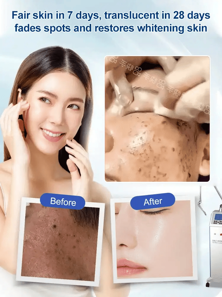 🔥Buy 1 Get 1 Free🔥Spot Fading Urea Cream