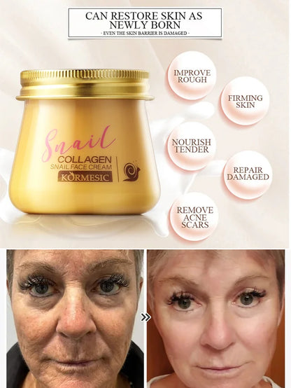🔥Buy 1 Get 1 Free🔥Snail Hydrating Anti-Wrinkle and Rejuvenating Cream