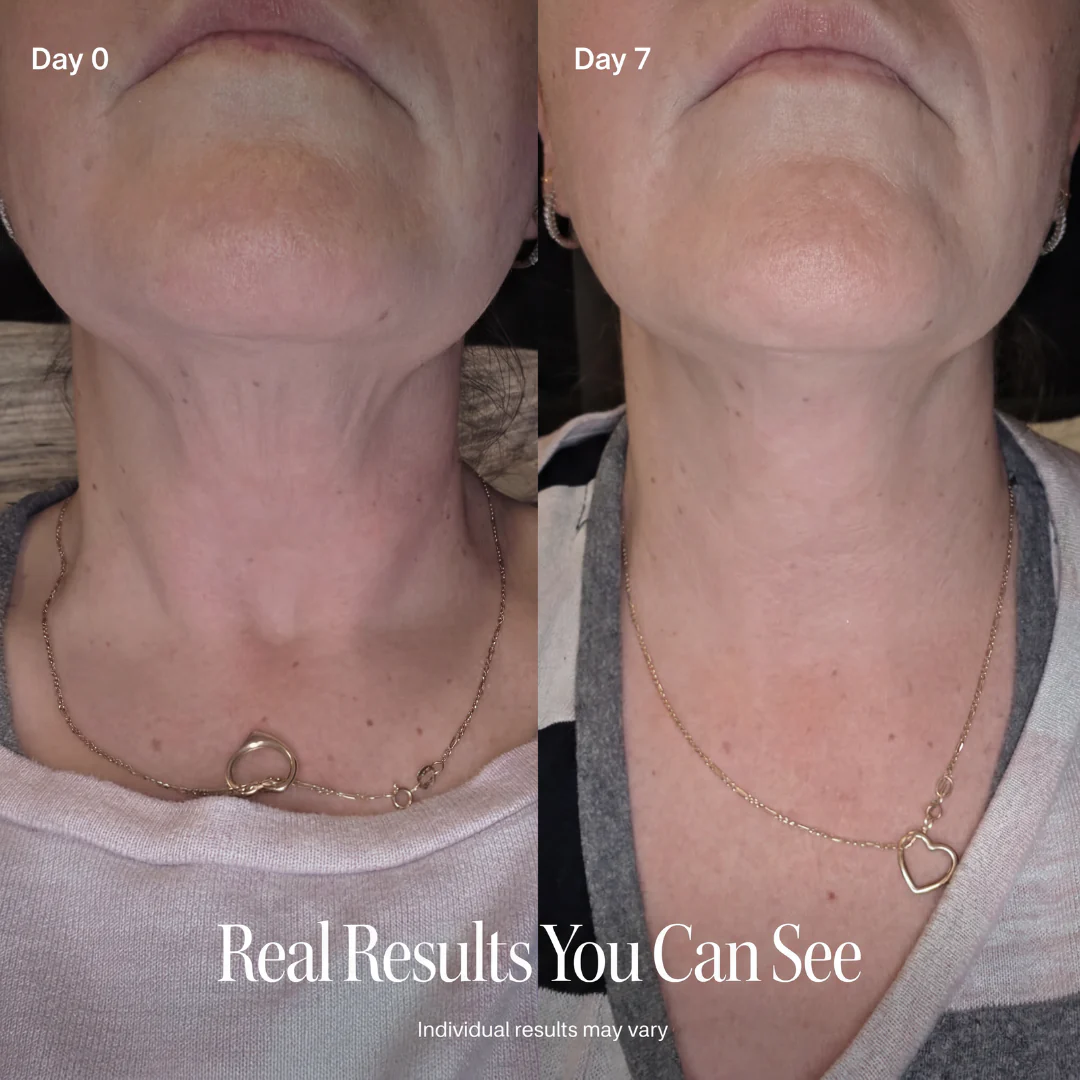 🥳CELESTVÉRA🔥 Face Slimming Cream✨