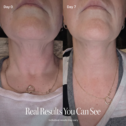 🥳CELESTVÉRA🔥 Face Slimming Cream✨