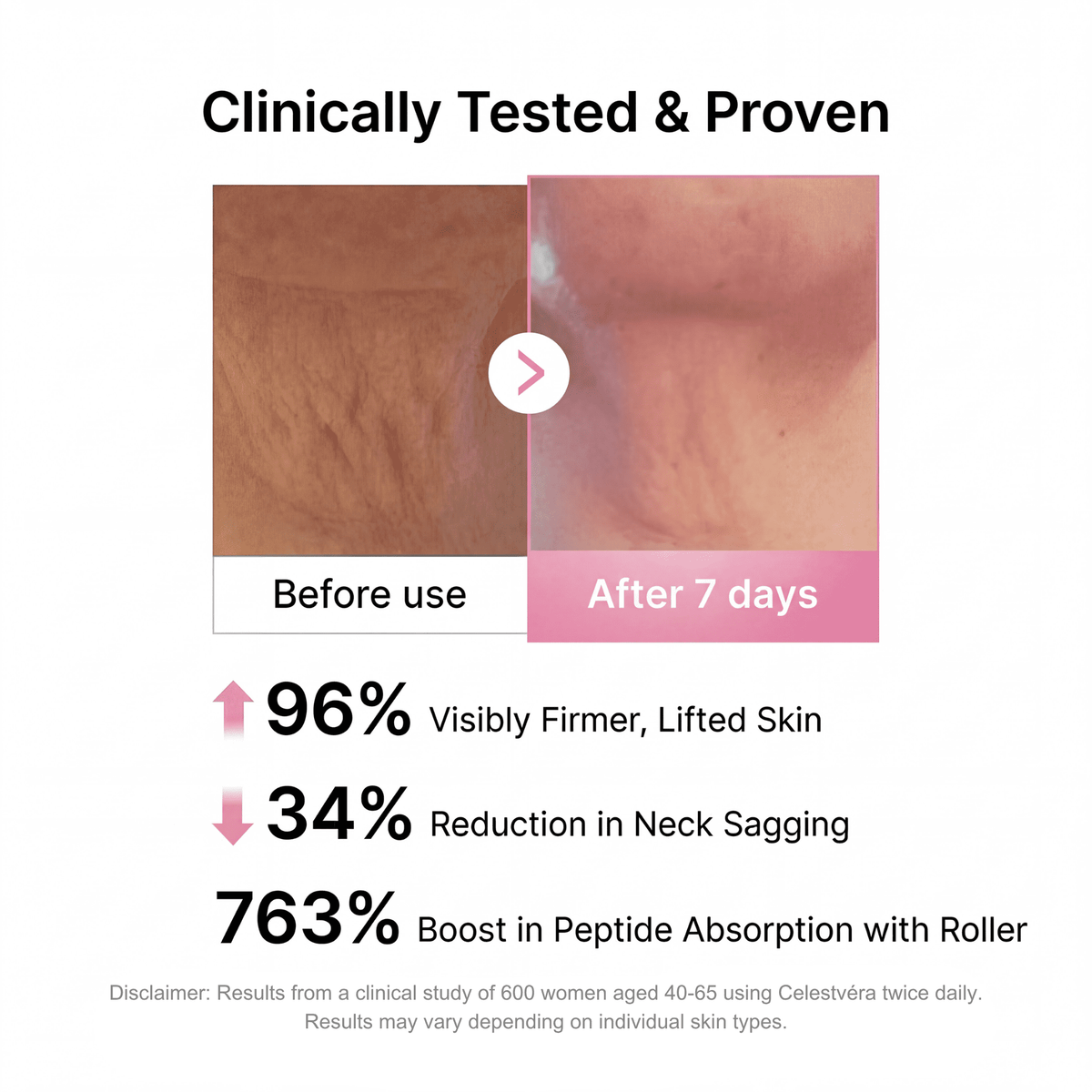 🥳CELESTVÉRA🔥 Face Slimming Cream✨