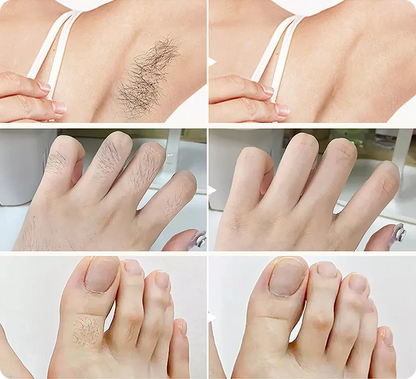 🥥 Painless hair removal, gently inhibits hair growth: Coconut hair removal cream